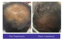 Before-After-5