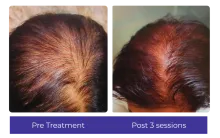 Before-After-6
