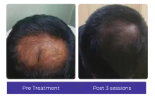 Before-After-8