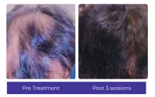 Before-After-9