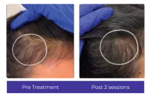 Before-After-1