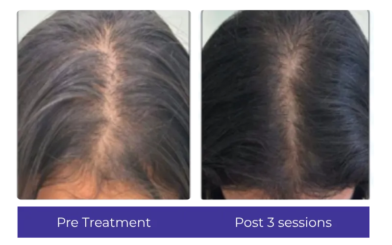Before-After-2