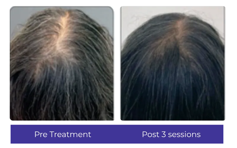 Before-After-3