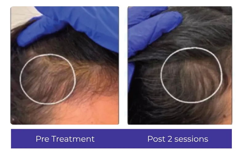 Before-After-1