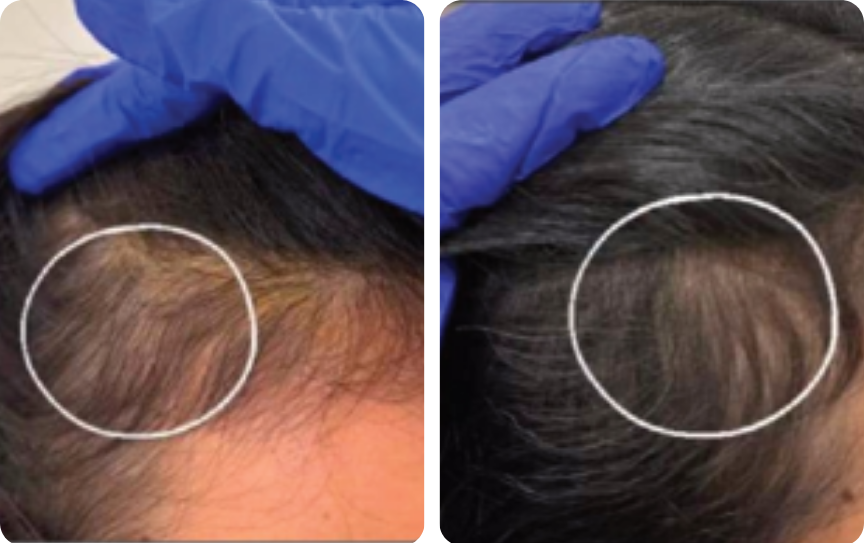 Hair result — visible improvement